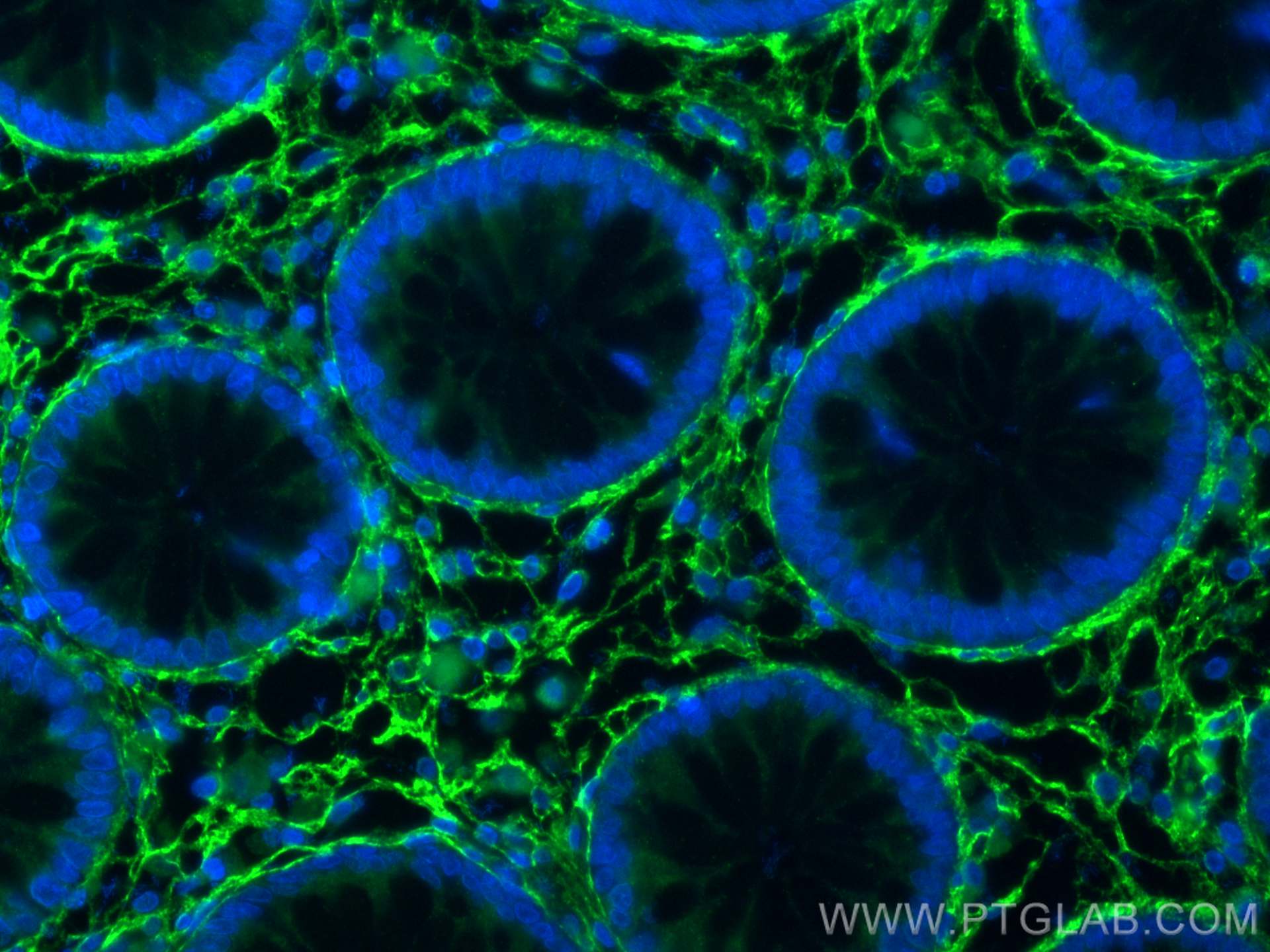 Immunofluorescence (IF) / fluorescent staining of human colon tissue using Collagen Type VI Polyclonal antibody (17023-1-AP)