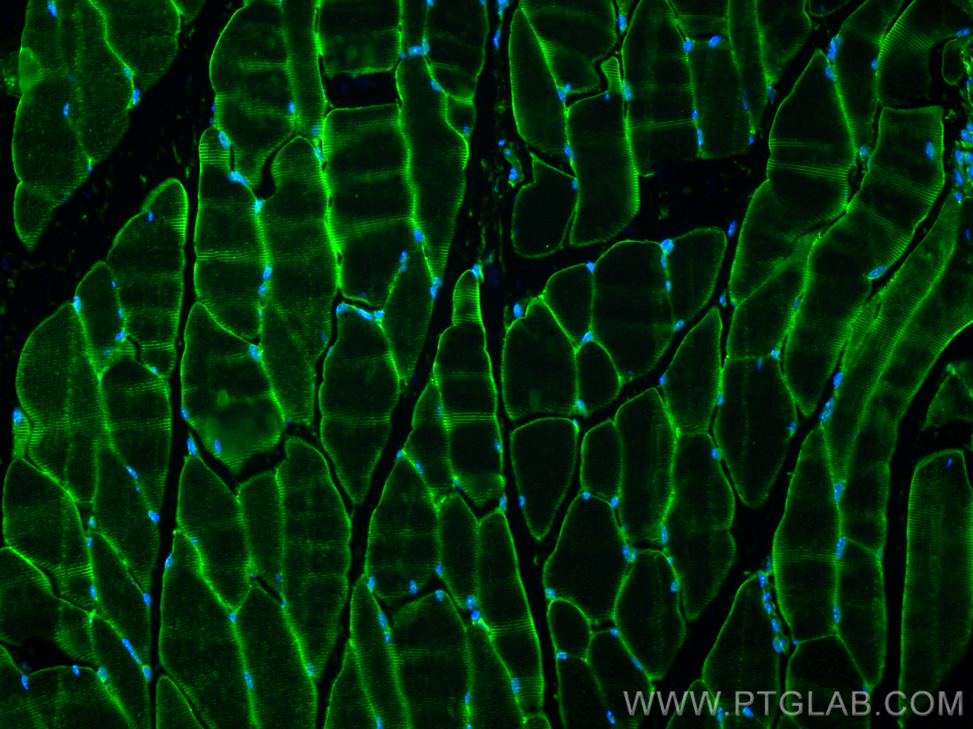 Immunofluorescence (IF) / fluorescent staining of mouse skeletal muscle tissue using Collagen Type VI Polyclonal antibody (17023-1-AP)