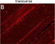 Collagen Type VI