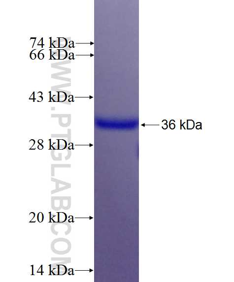 COMMD6 fusion protein Ag26778 SDS-PAGE