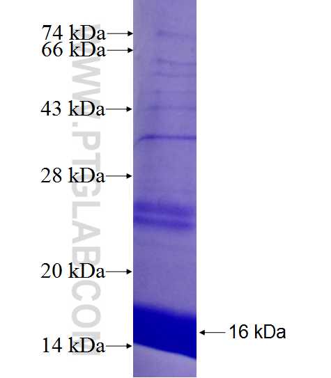 COMMD6 fusion protein Ag26805 SDS-PAGE