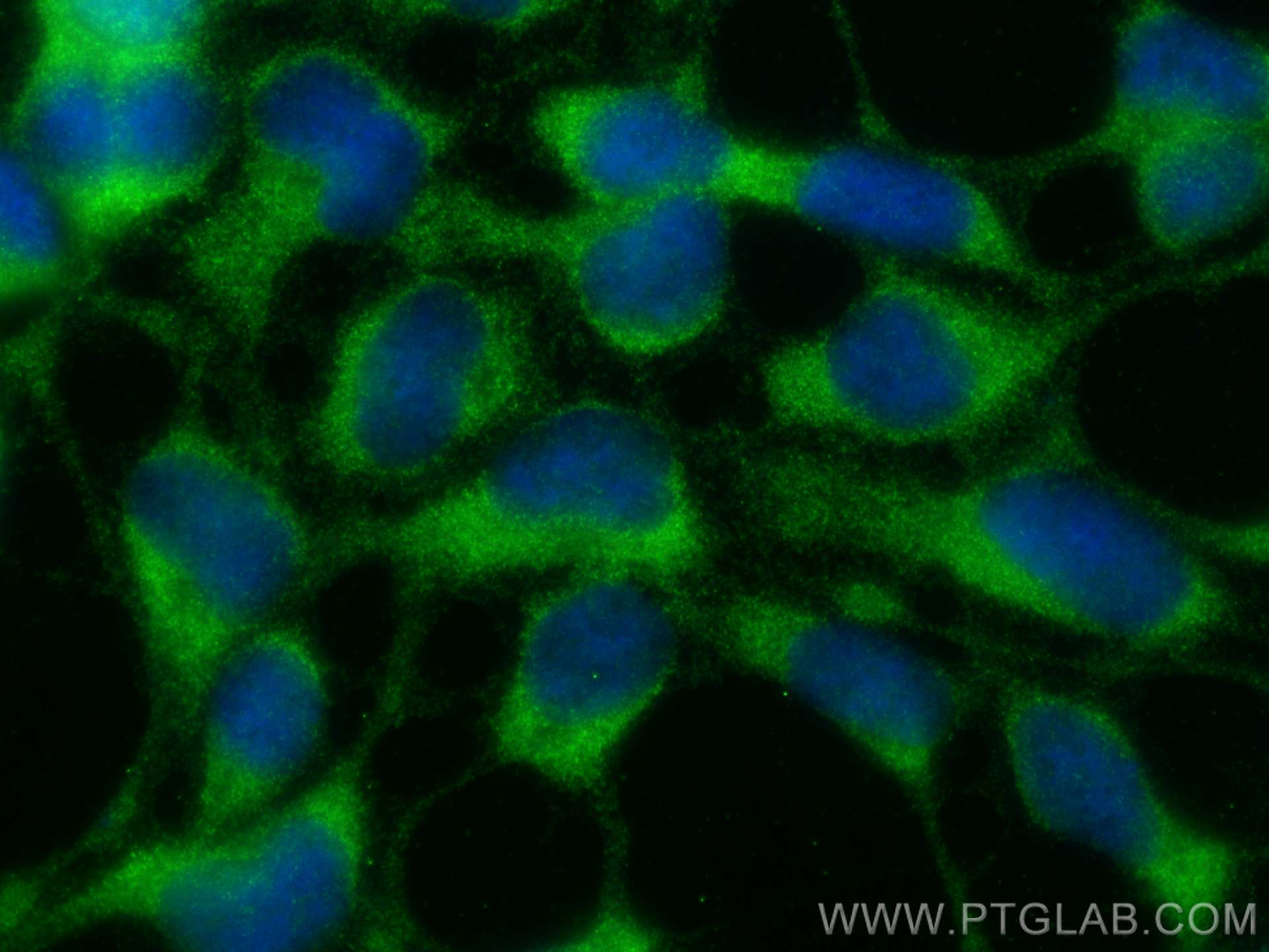 Immunofluorescence (IF) / fluorescent staining of HEK-293 cells using COMMD8 Polyclonal antibody (25237-1-AP)