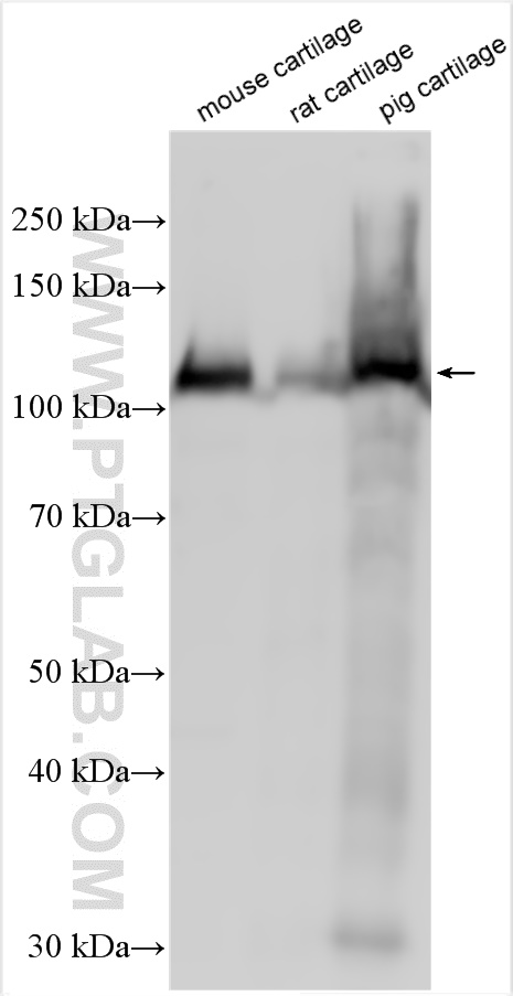 Western Blot (WB) analysis of various lysates using COMP Polyclonal antibody (28369-1-AP)