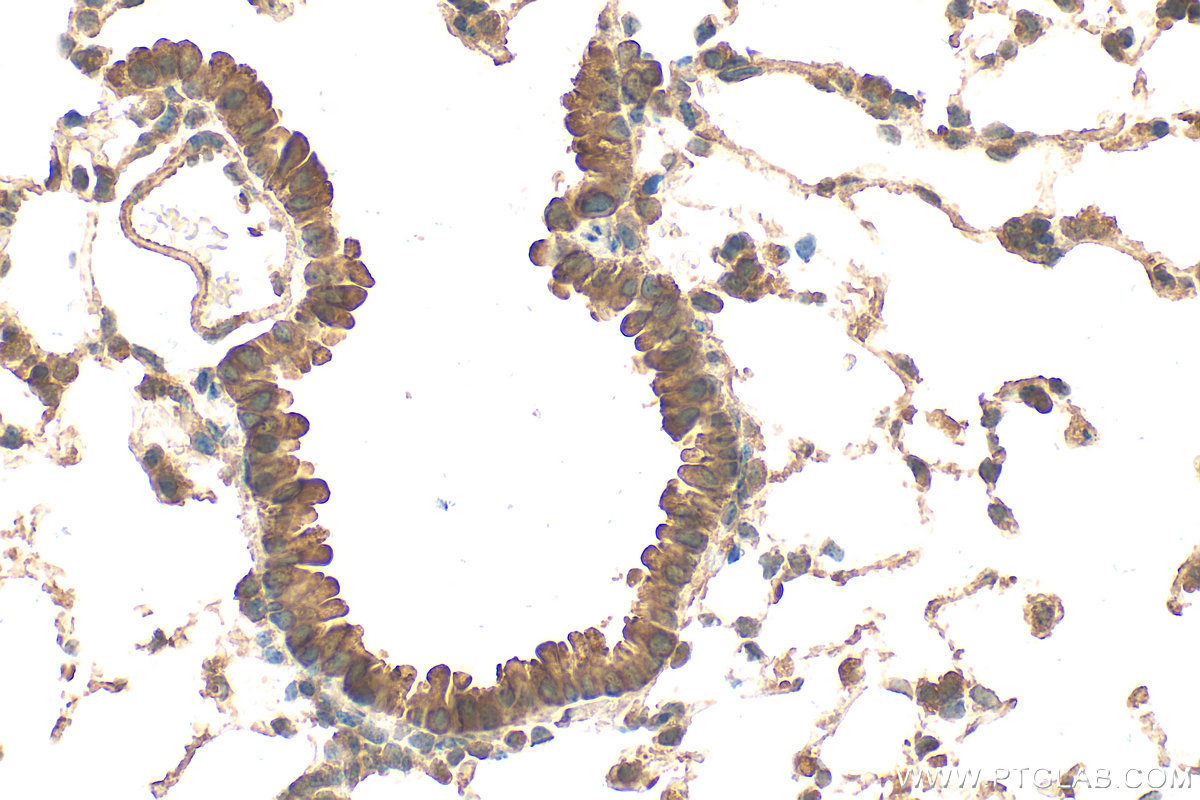 Immunohistochemistry (IHC) staining of mouse lung tissue using COMT Polyclonal antibody (14754-1-AP)