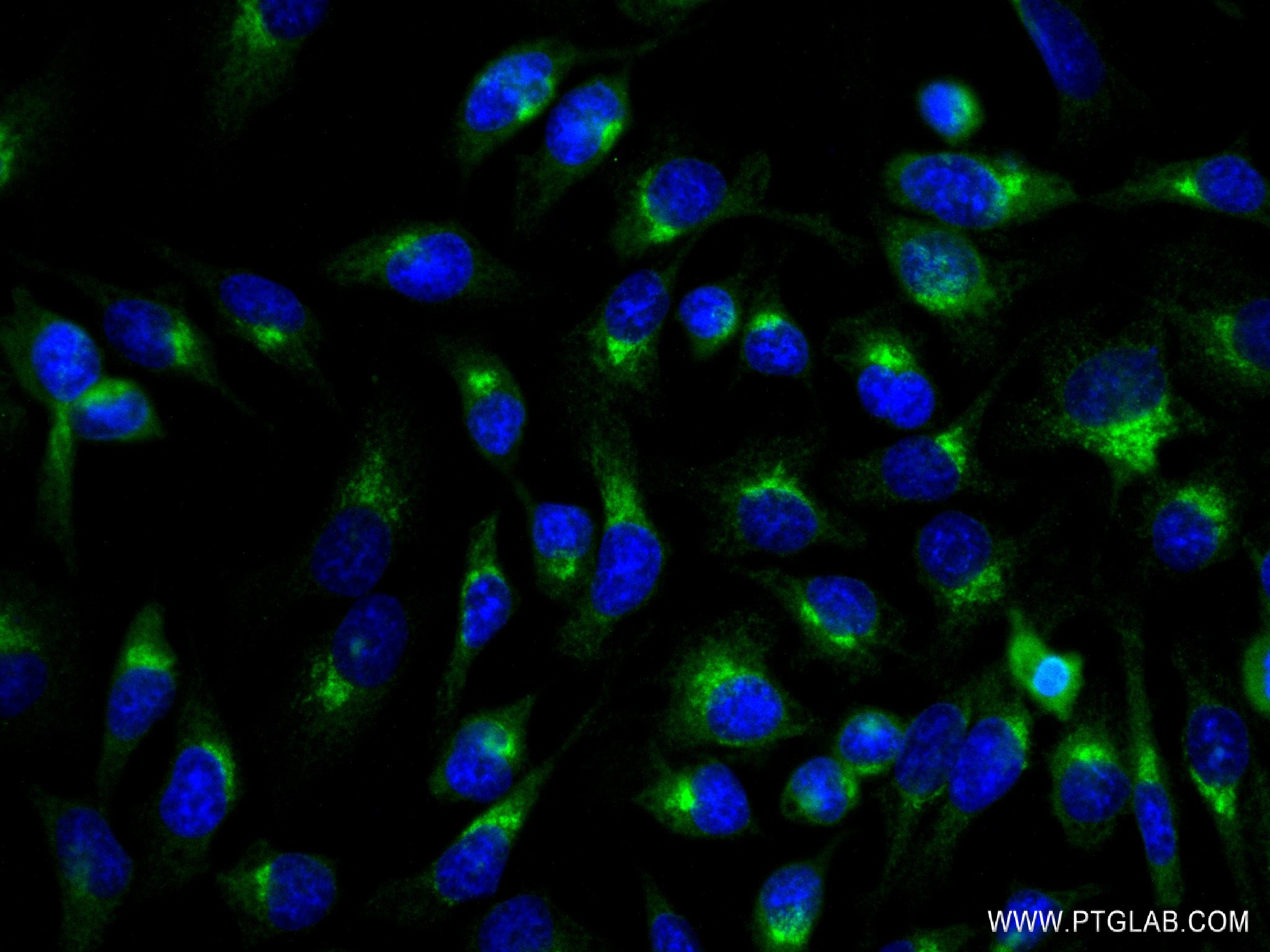 Immunofluorescence (IF) / fluorescent staining of HeLa cells using COPA Recombinant antibody (83089-1-RR)