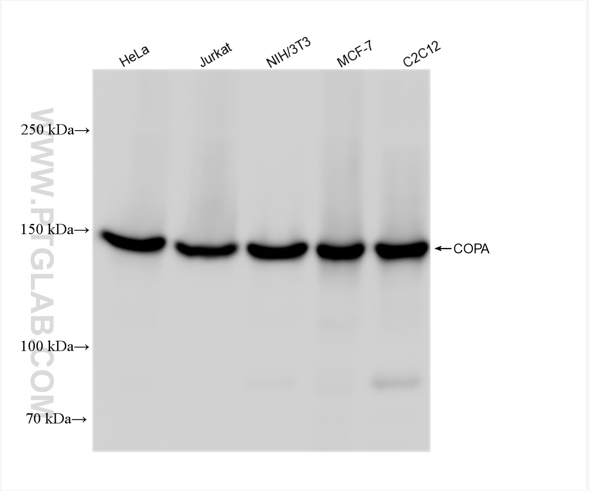 Western Blot (WB) analysis of various lysates using COPA Recombinant antibody (83089-1-RR)