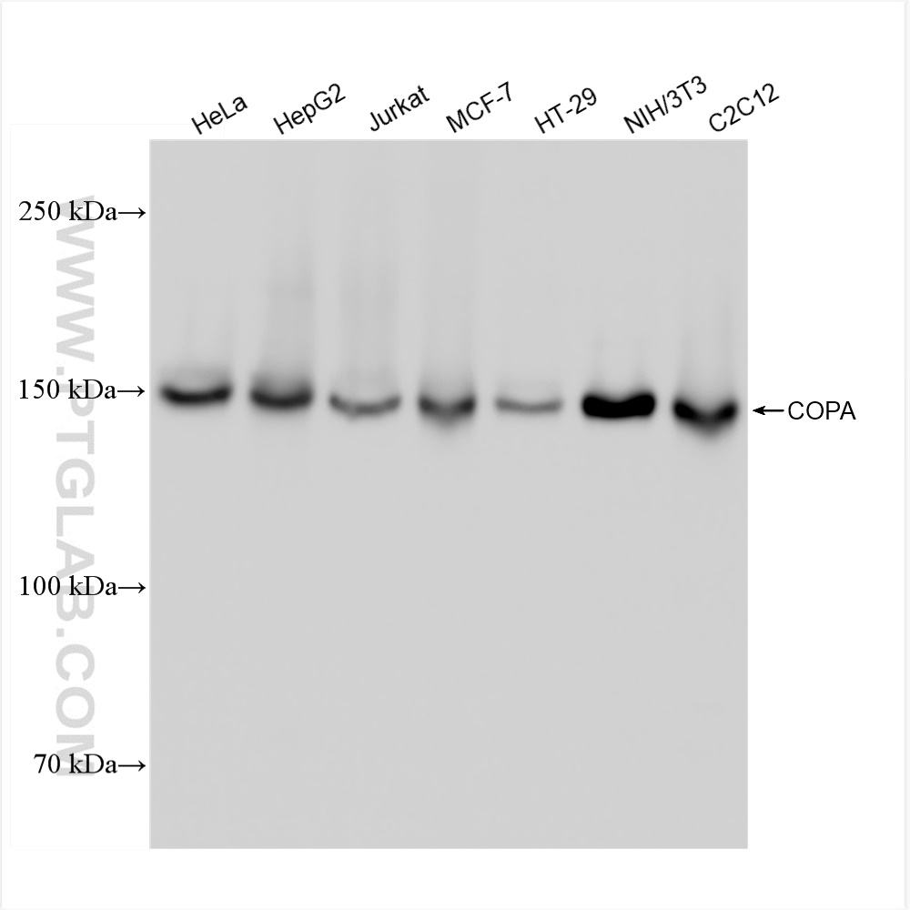 Western Blot (WB) analysis of various lysates using COPA Recombinant antibody (83089-2-RR)