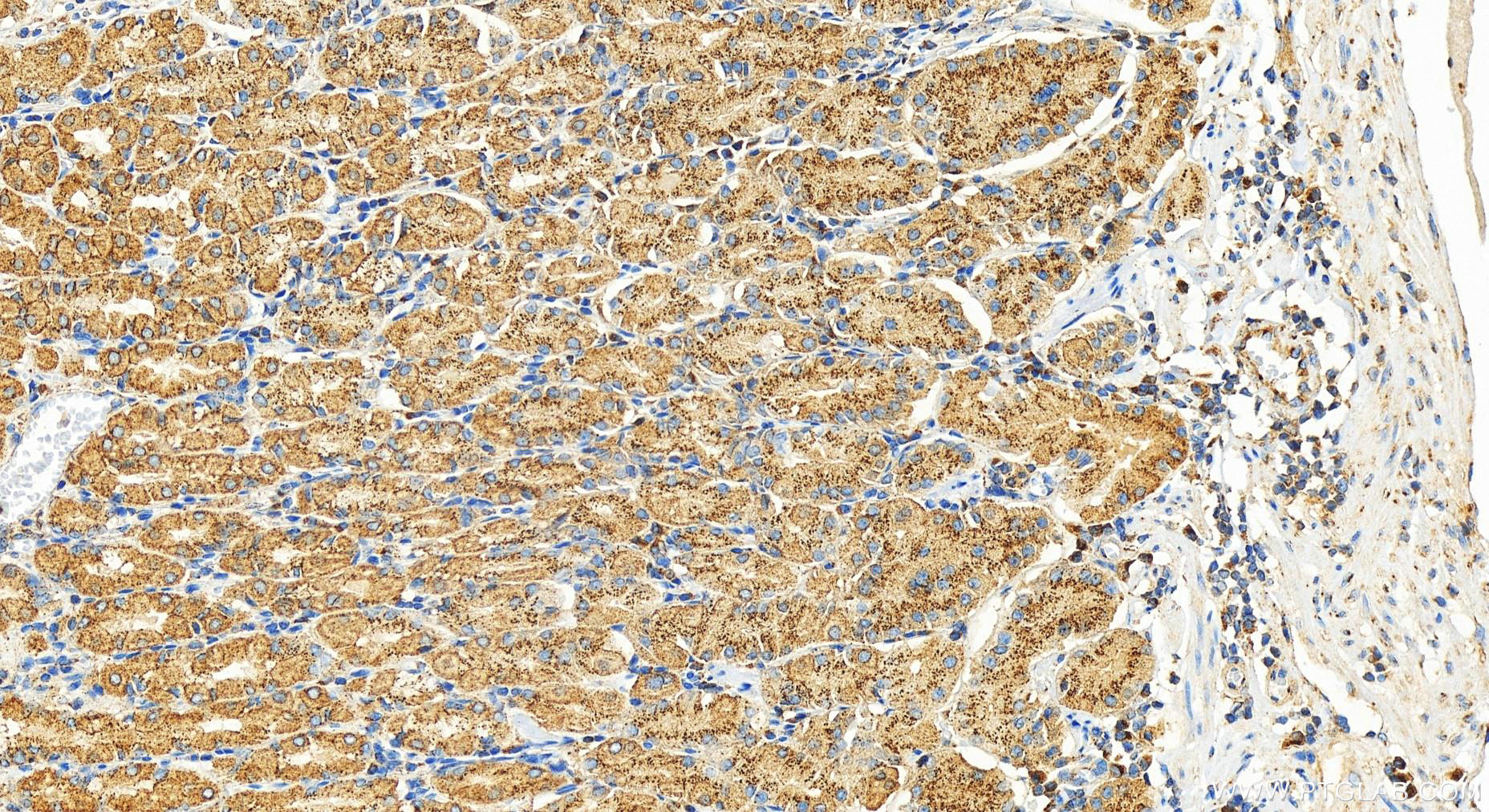 Immunohistochemistry (IHC) staining of human stomach tissue using COPB2 Polyclonal antibody (14733-1-AP)