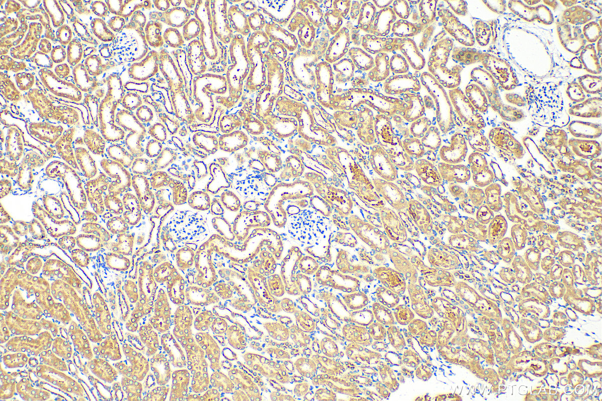 Immunohistochemistry (IHC) staining of mouse kidney tissue using COPG Polyclonal antibody (12393-1-AP)