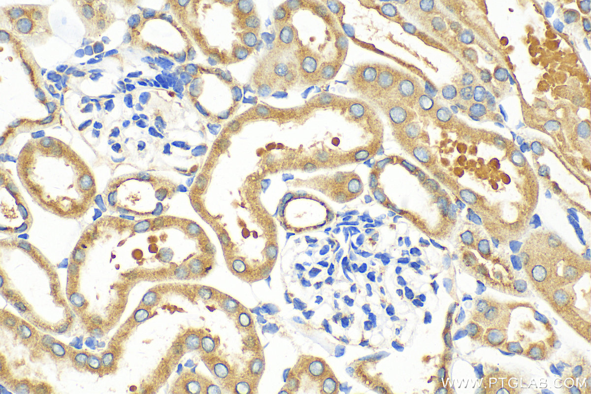 Immunohistochemistry (IHC) staining of mouse kidney tissue using COPG Polyclonal antibody (12393-1-AP)