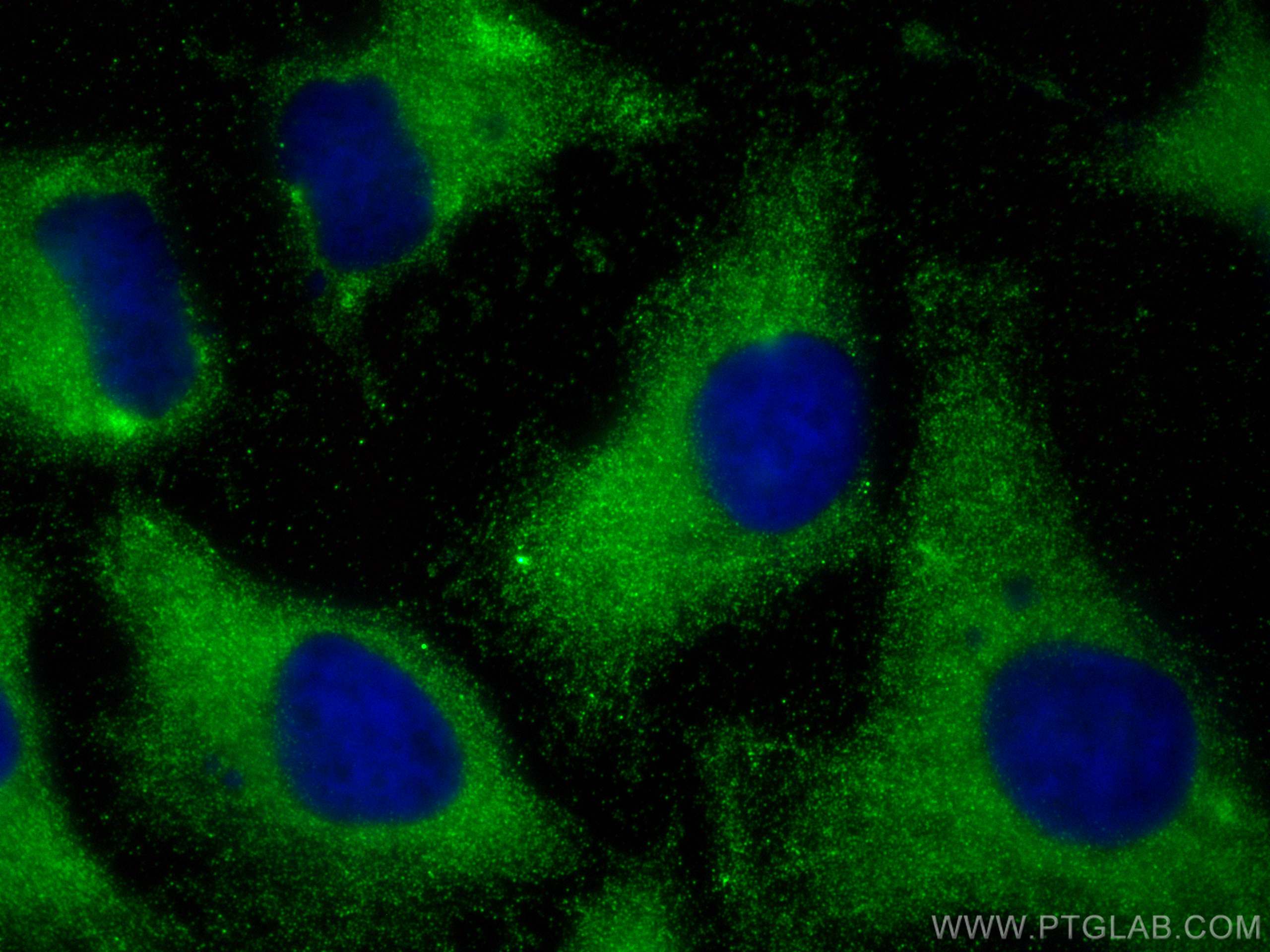 Immunofluorescence (IF) / fluorescent staining of HeLa cells using CSN2 Polyclonal antibody (10969-2-AP)