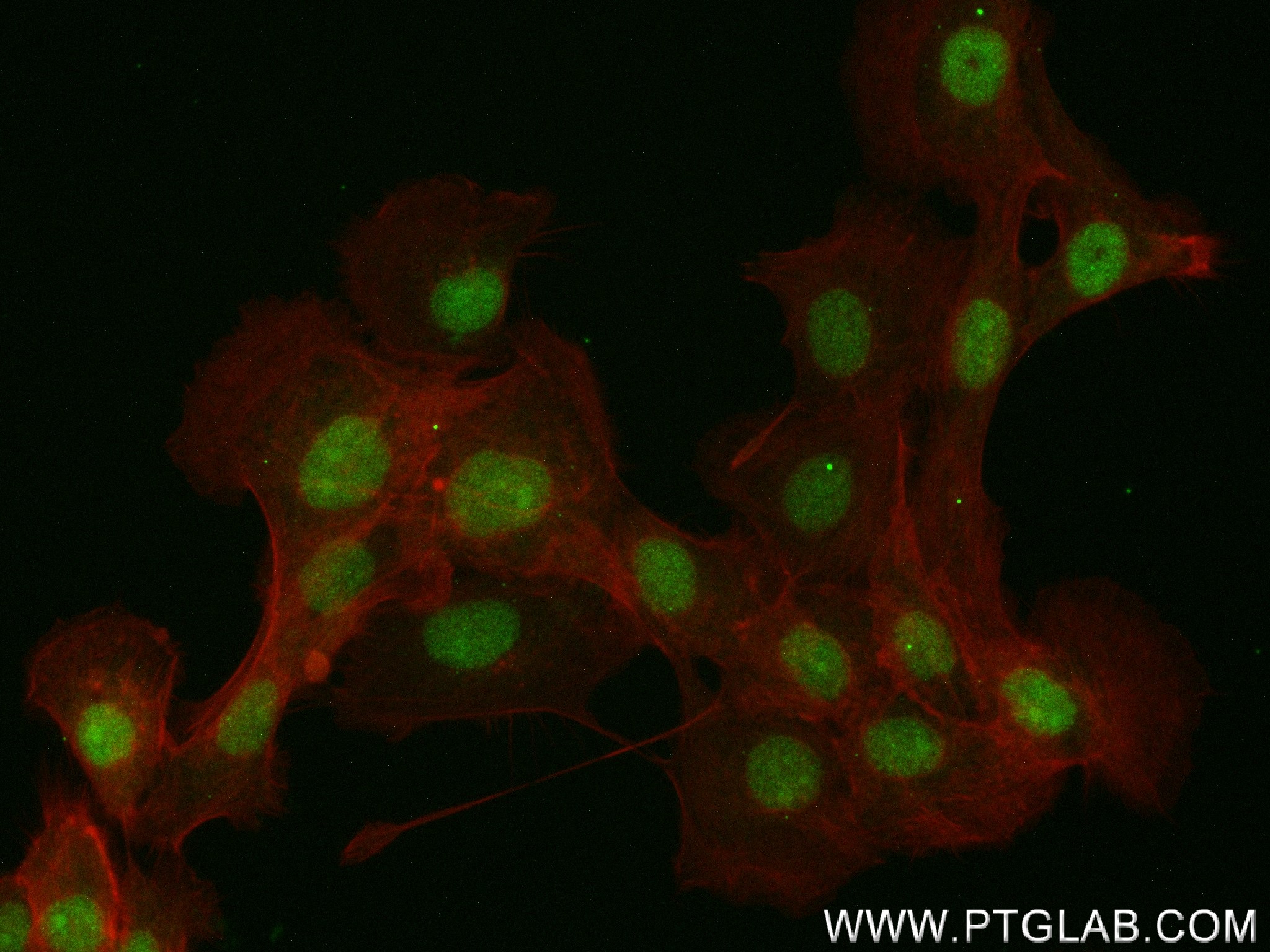 Immunofluorescence (IF) / fluorescent staining of A431 cells using COPS3 Recombinant antibody (83822-2-RR)