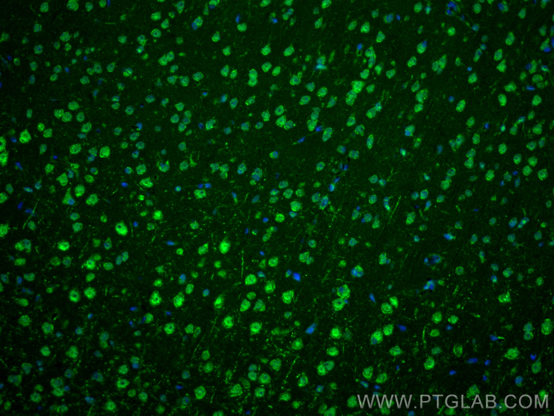 Immunofluorescence (IF) / fluorescent staining of rat brain tissue using COPS3 Recombinant antibody (83822-2-RR)