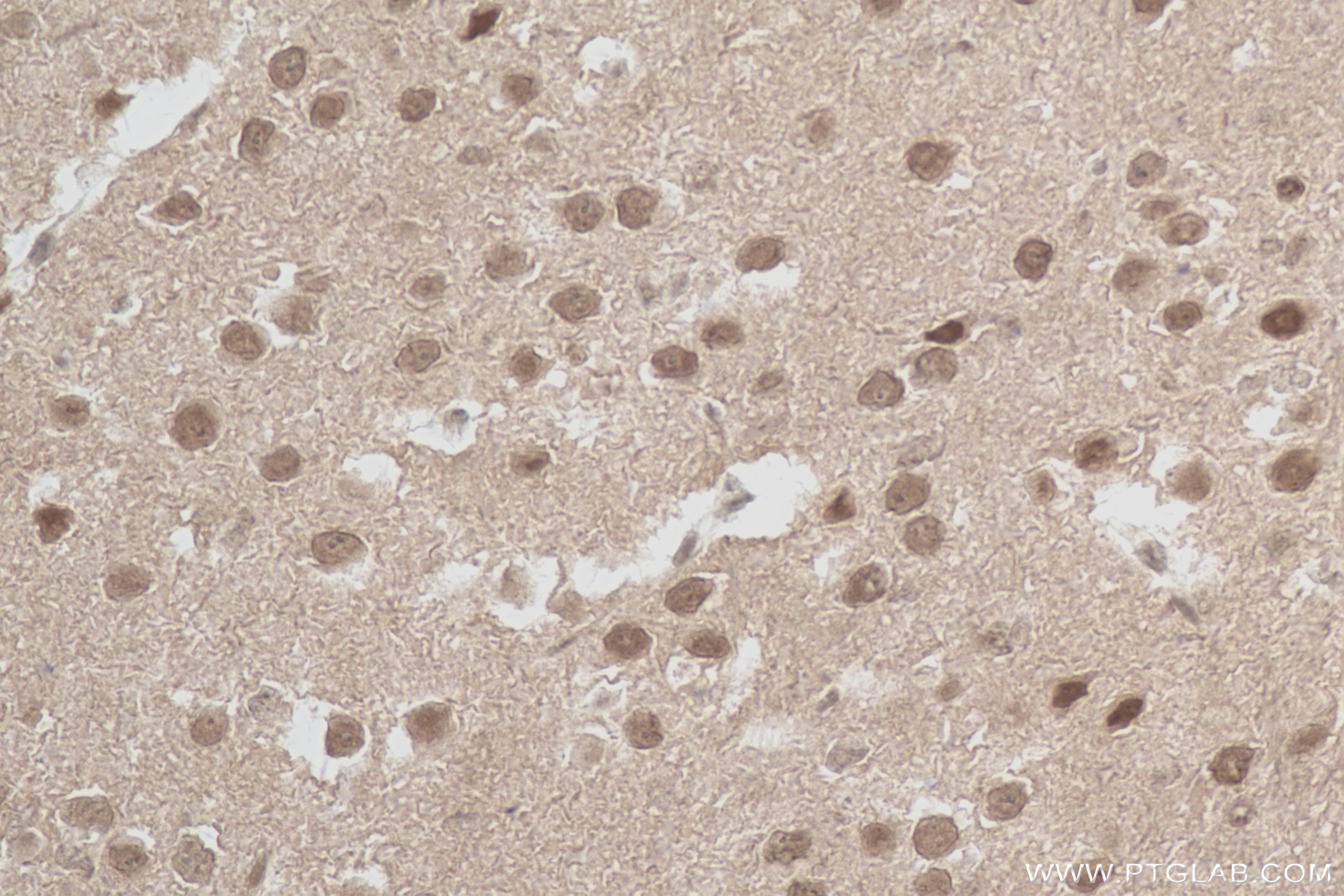 Immunohistochemistry (IHC) staining of mouse brain tissue using COPS3 Recombinant antibody (83822-2-RR)