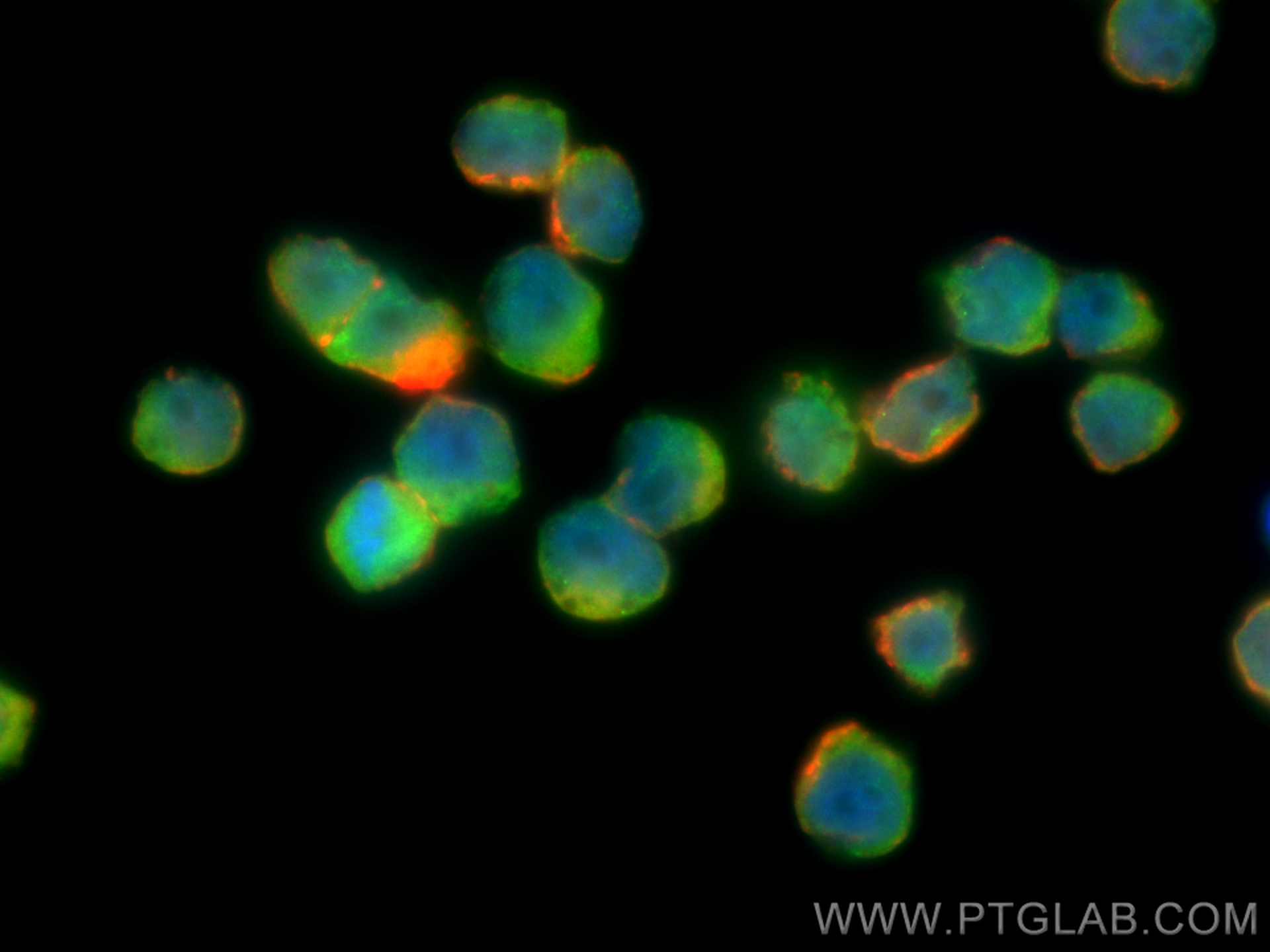 Immunofluorescence (IF) / fluorescent staining of COLO 320 cells using COPS6 Polyclonal antibody (10256-1-AP)