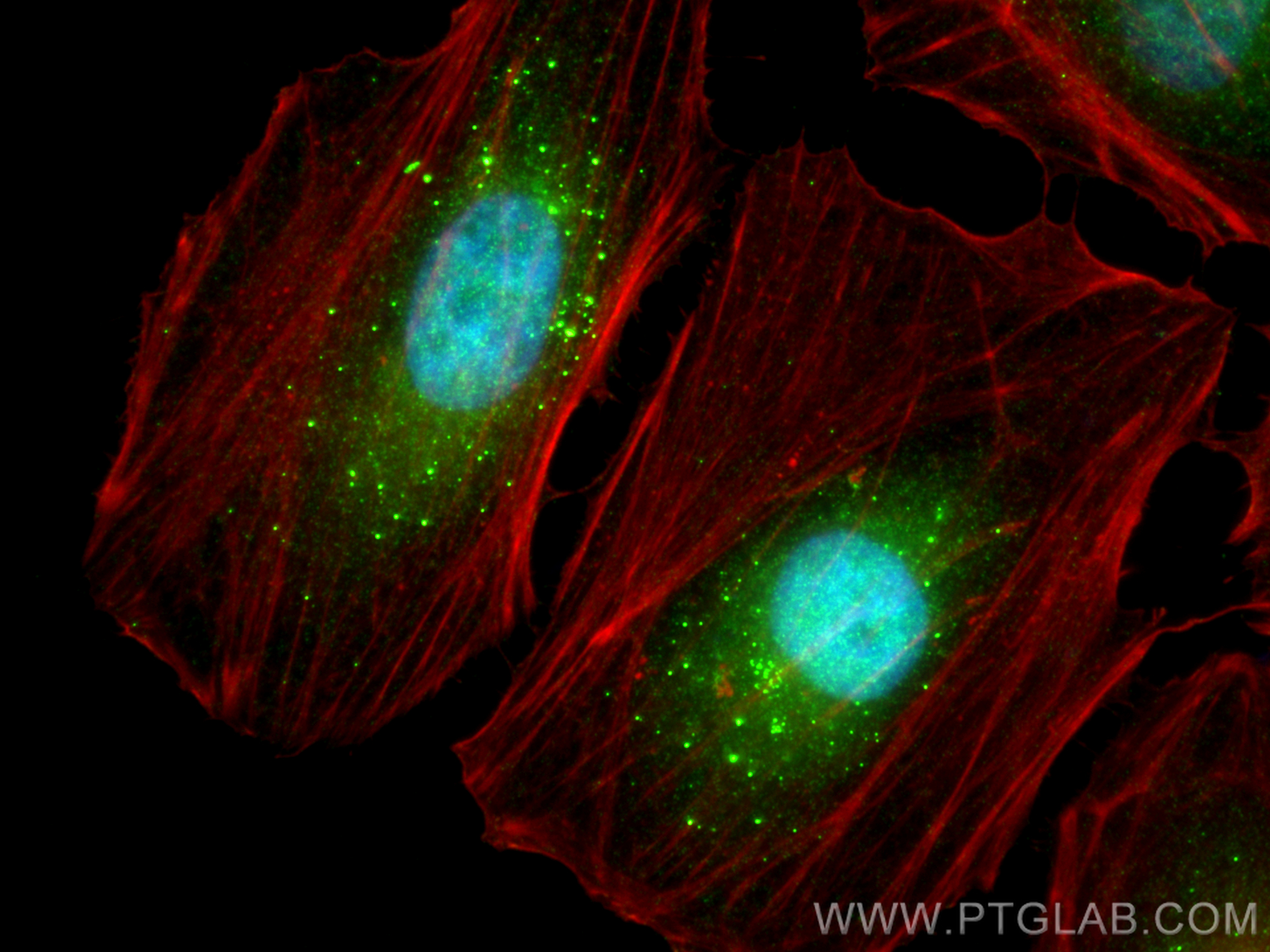 Immunofluorescence (IF) / fluorescent staining of HeLa cells using COPS6 Polyclonal antibody (10256-1-AP)