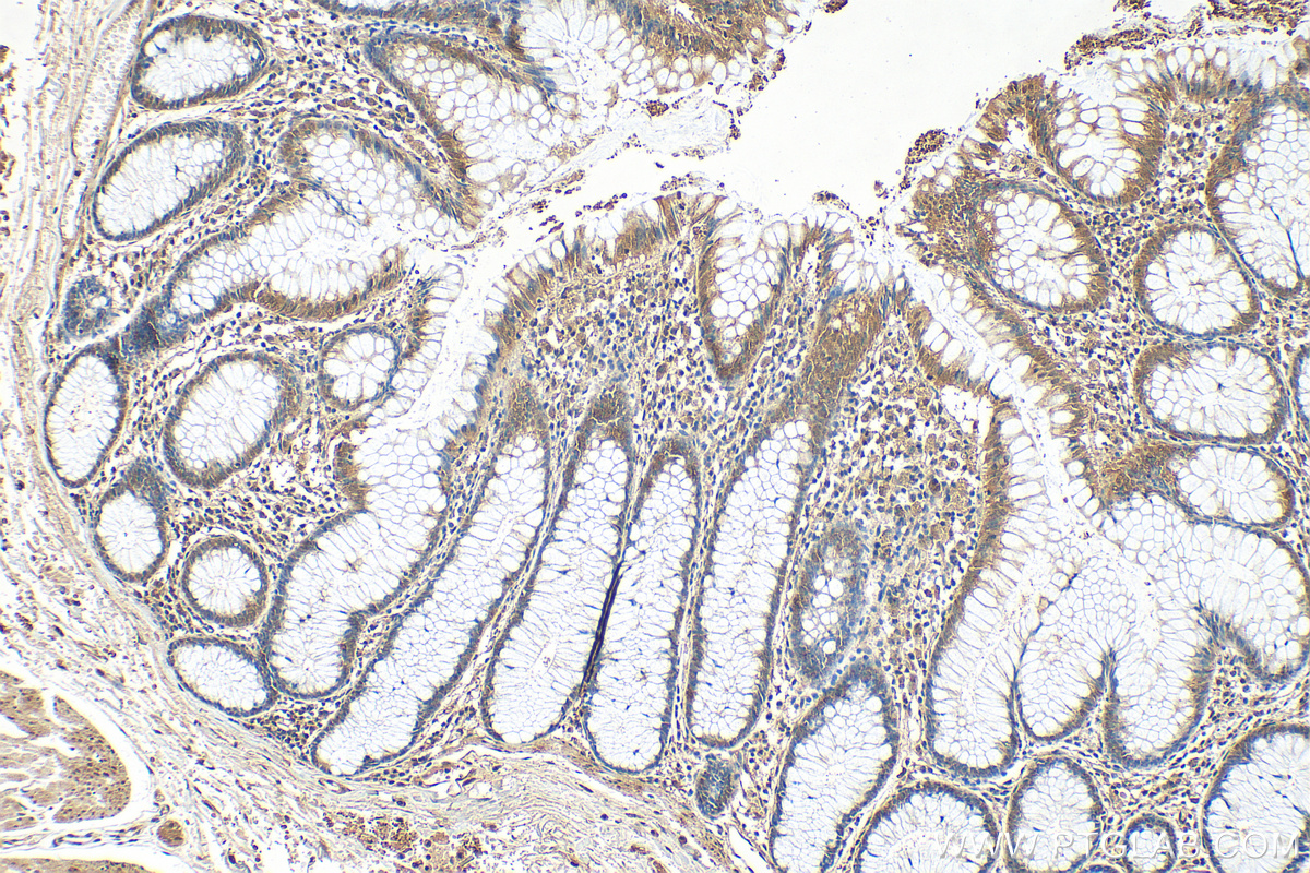 Immunohistochemistry (IHC) staining of human colon tissue using COPS6 Polyclonal antibody (10256-1-AP)