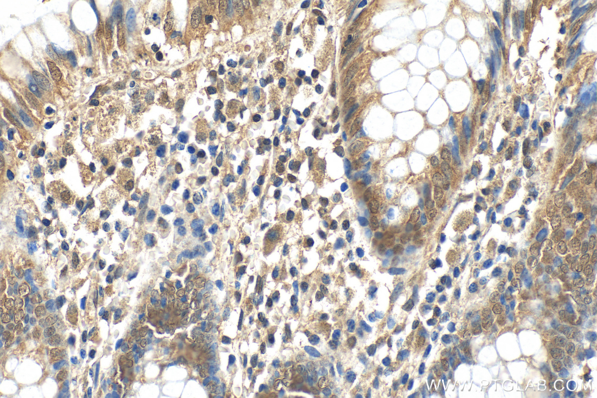 Immunohistochemistry (IHC) staining of human colon tissue using COPS6 Polyclonal antibody (10256-1-AP)