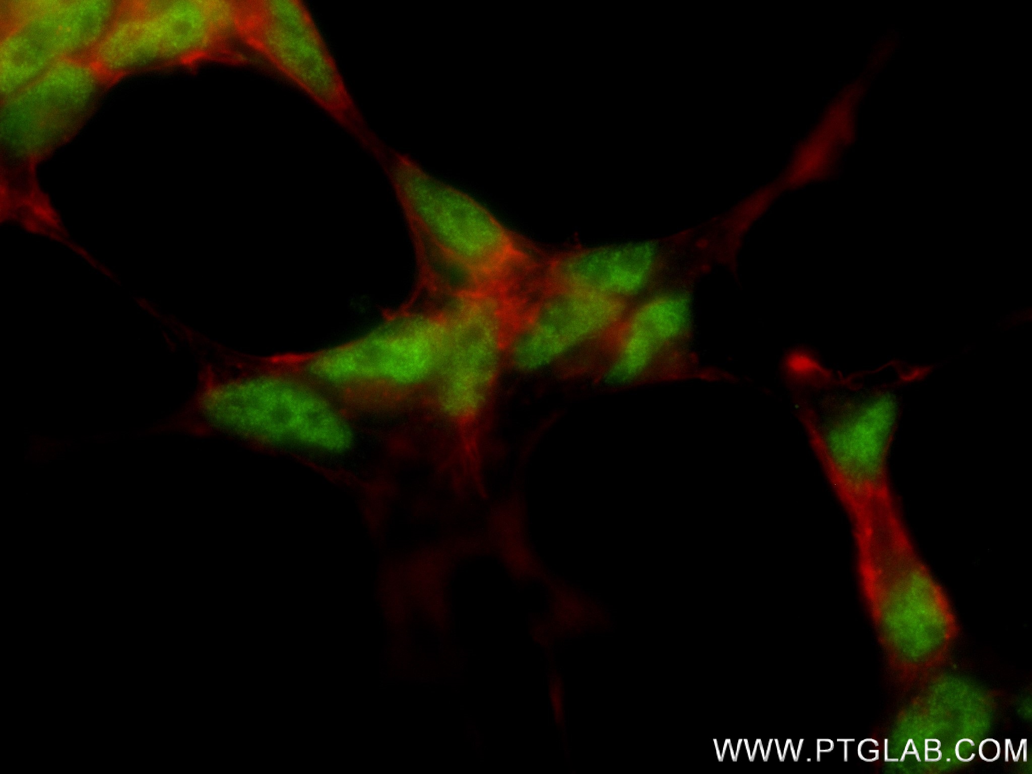 Immunofluorescence (IF) / fluorescent staining of SH-SY5Y cells using COPS8 Recombinant antibody (83312-1-RR)