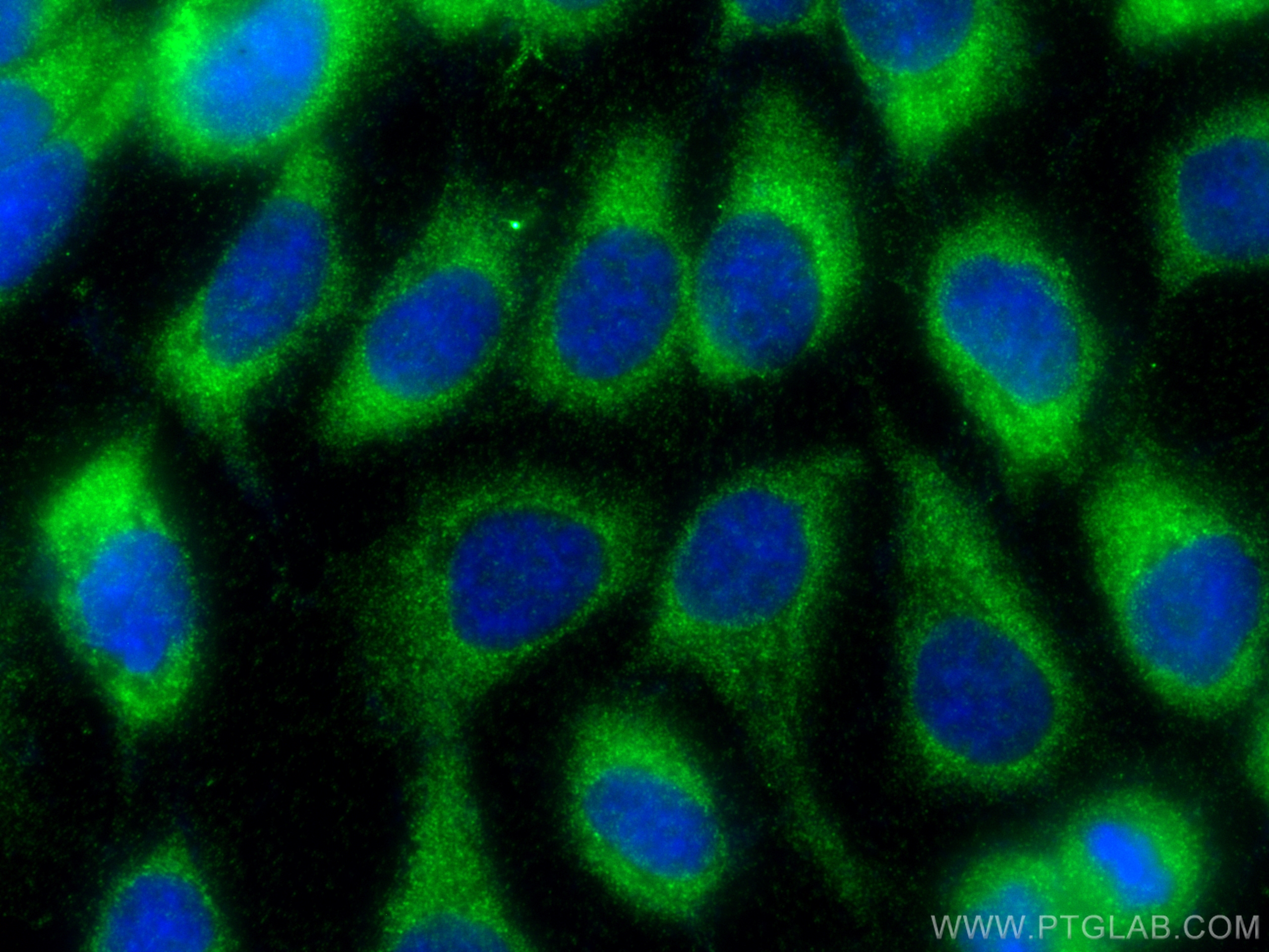 Immunofluorescence (IF) / fluorescent staining of A431 cells using COQ10B Polyclonal antibody (17269-1-AP)