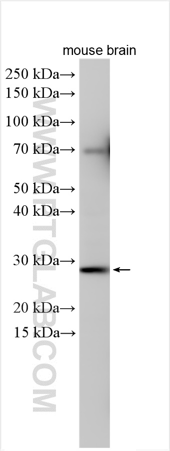 COQ10B