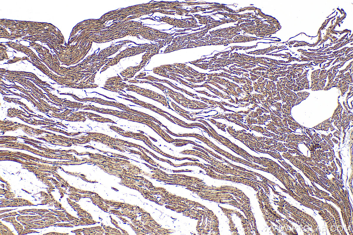 Immunohistochemistry (IHC) staining of mouse heart tissue using CORIN Recombinant antibody (83566-1-RR)