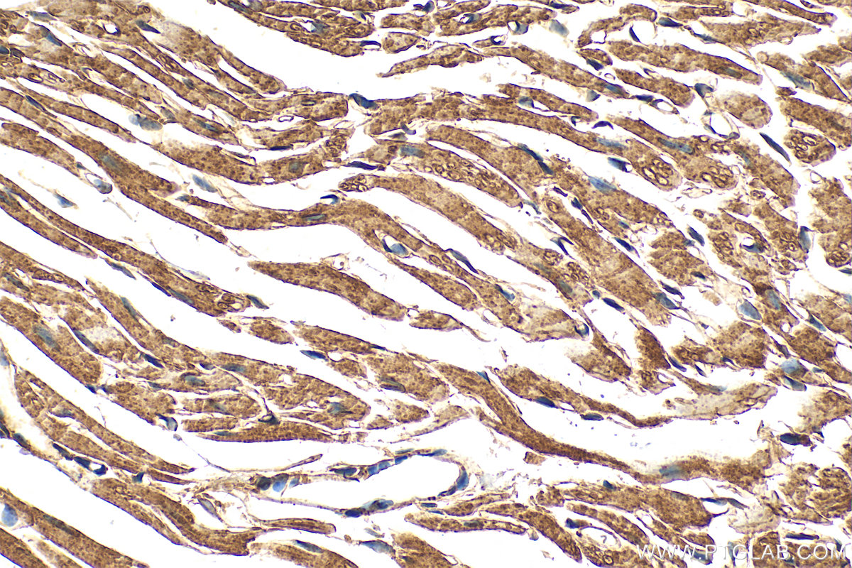 Immunohistochemistry (IHC) staining of mouse heart tissue using CORIN Recombinant antibody (83566-1-RR)