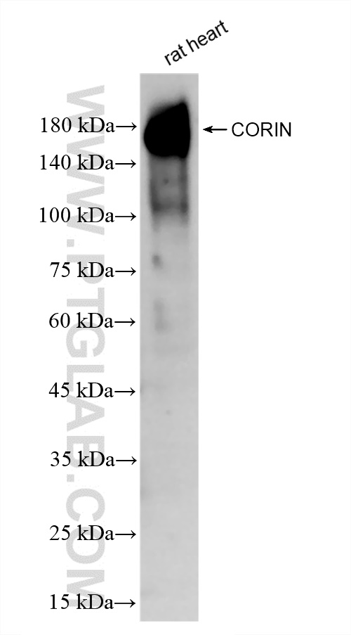 Western Blot (WB) analysis of rat heart tissue using CORIN Recombinant antibody (83566-1-RR)