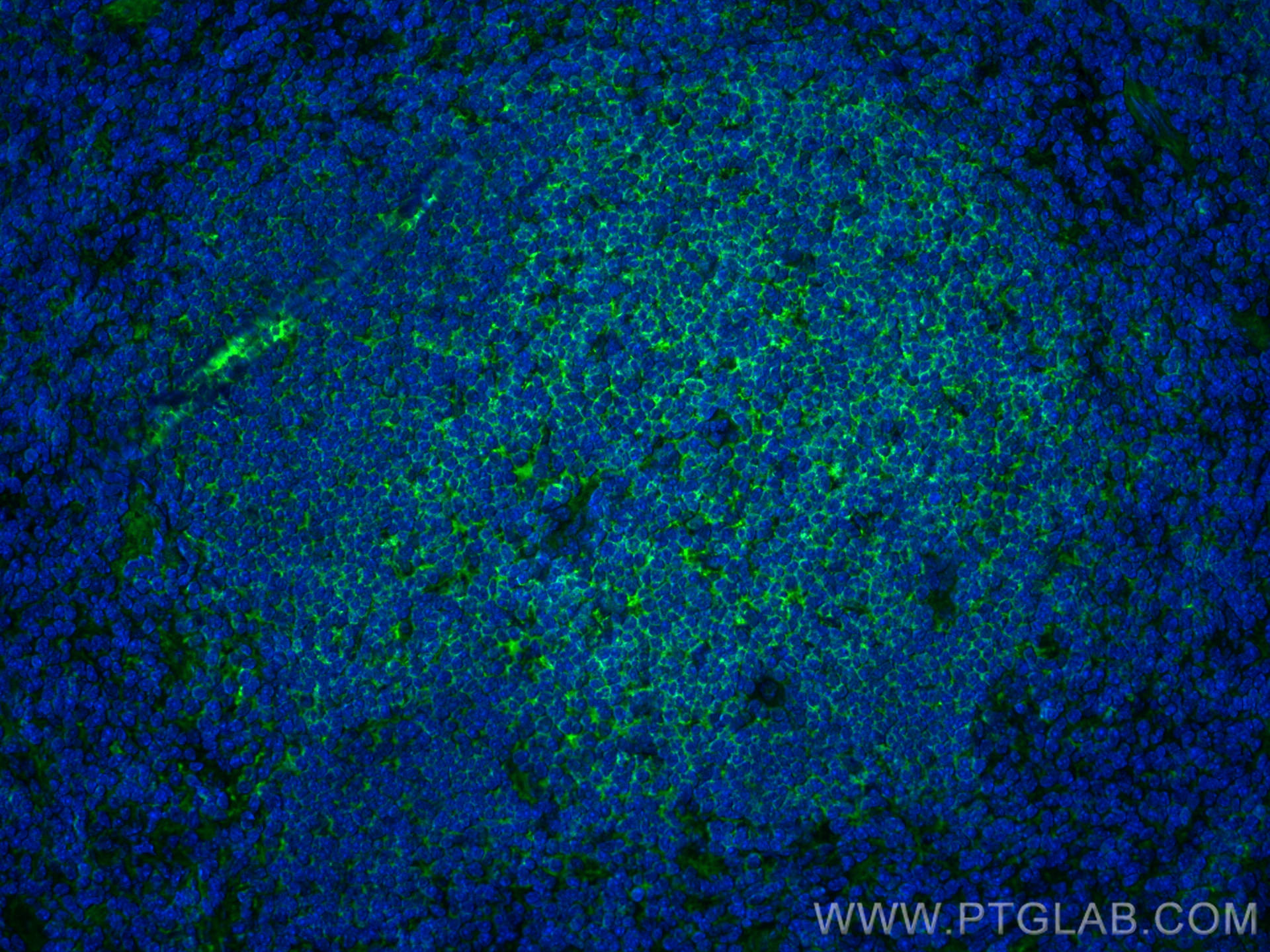 Immunofluorescence (IF) / fluorescent staining of mouse spleen tissue using CORO1A Polyclonal antibody (17760-1-AP)