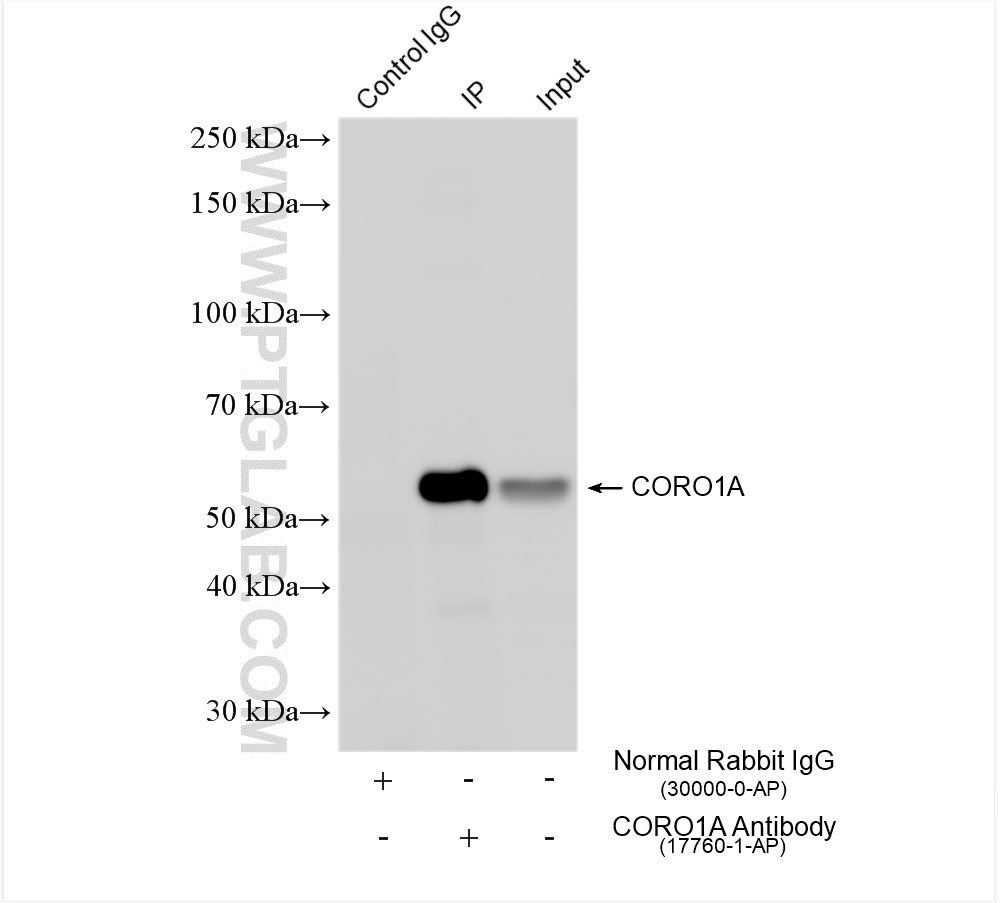 Immunoprecipitation (IP) experiment of mouse brain tissue using CORO1A Polyclonal antibody (17760-1-AP)