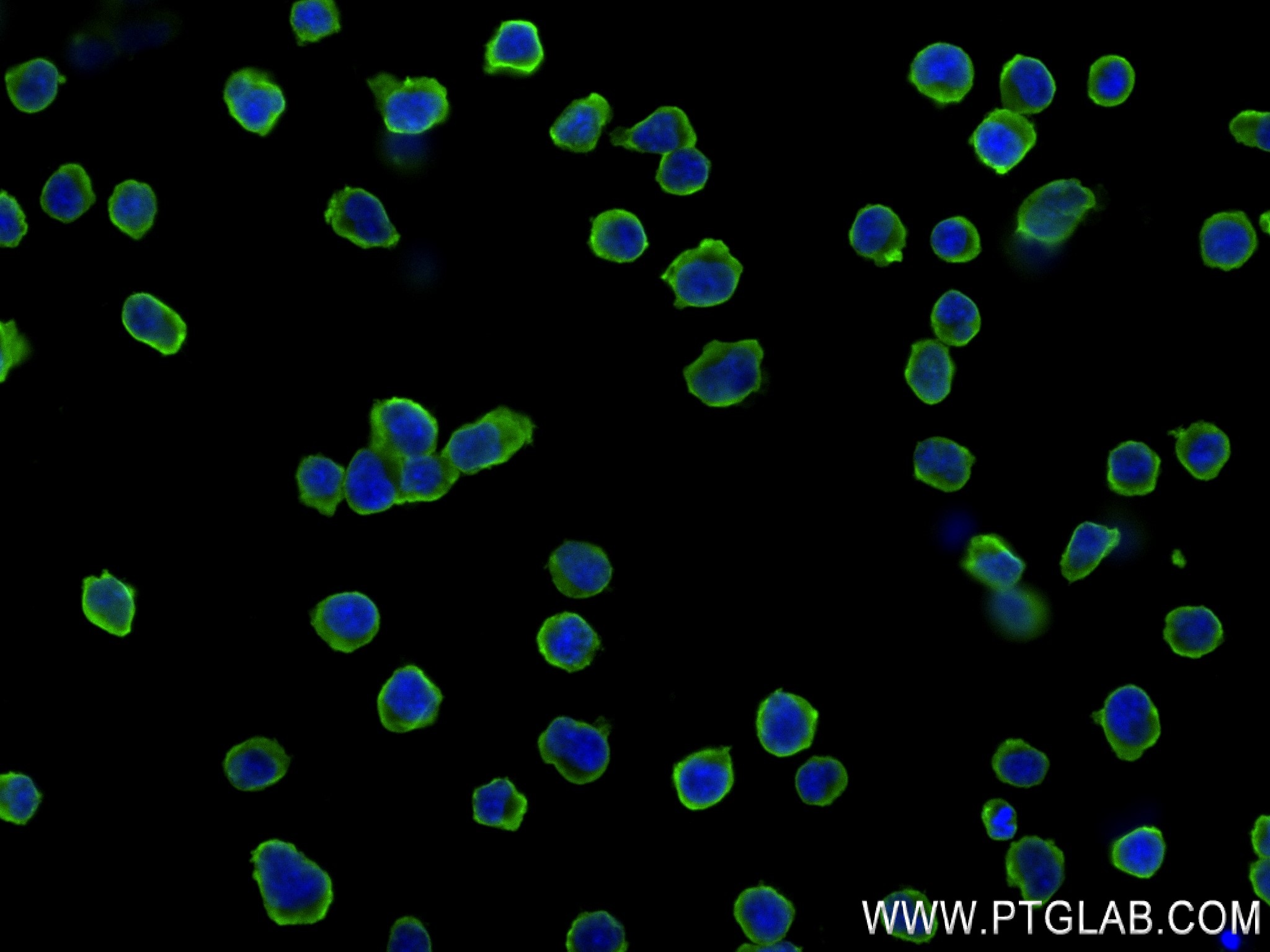 Immunofluorescence (IF) / fluorescent staining of Jurkat cells using CORO1A Recombinant antibody (84602-5-RR)