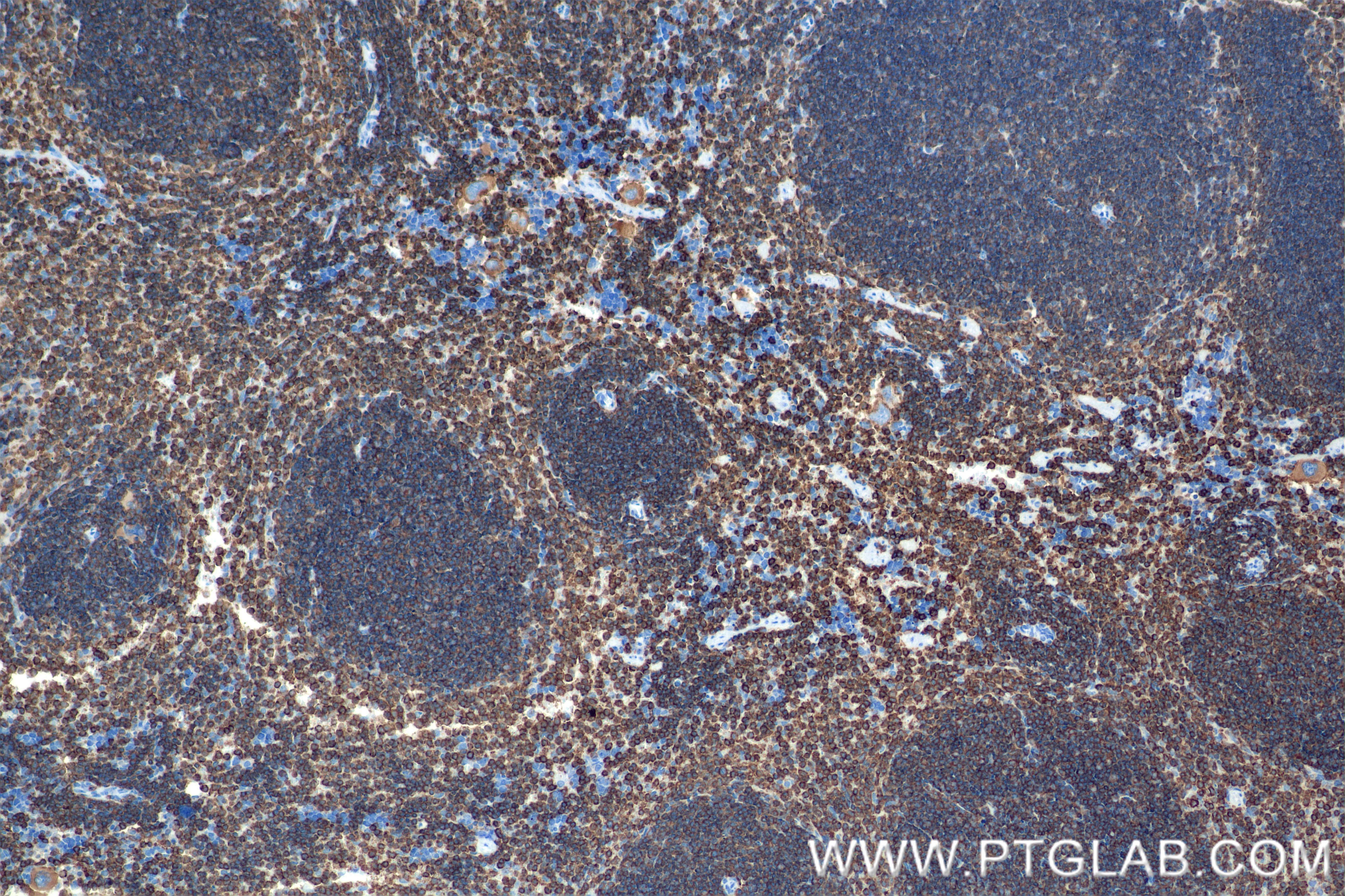 Immunohistochemistry (IHC) staining of mouse spleen tissue using CORO1A Recombinant antibody (84602-5-RR)