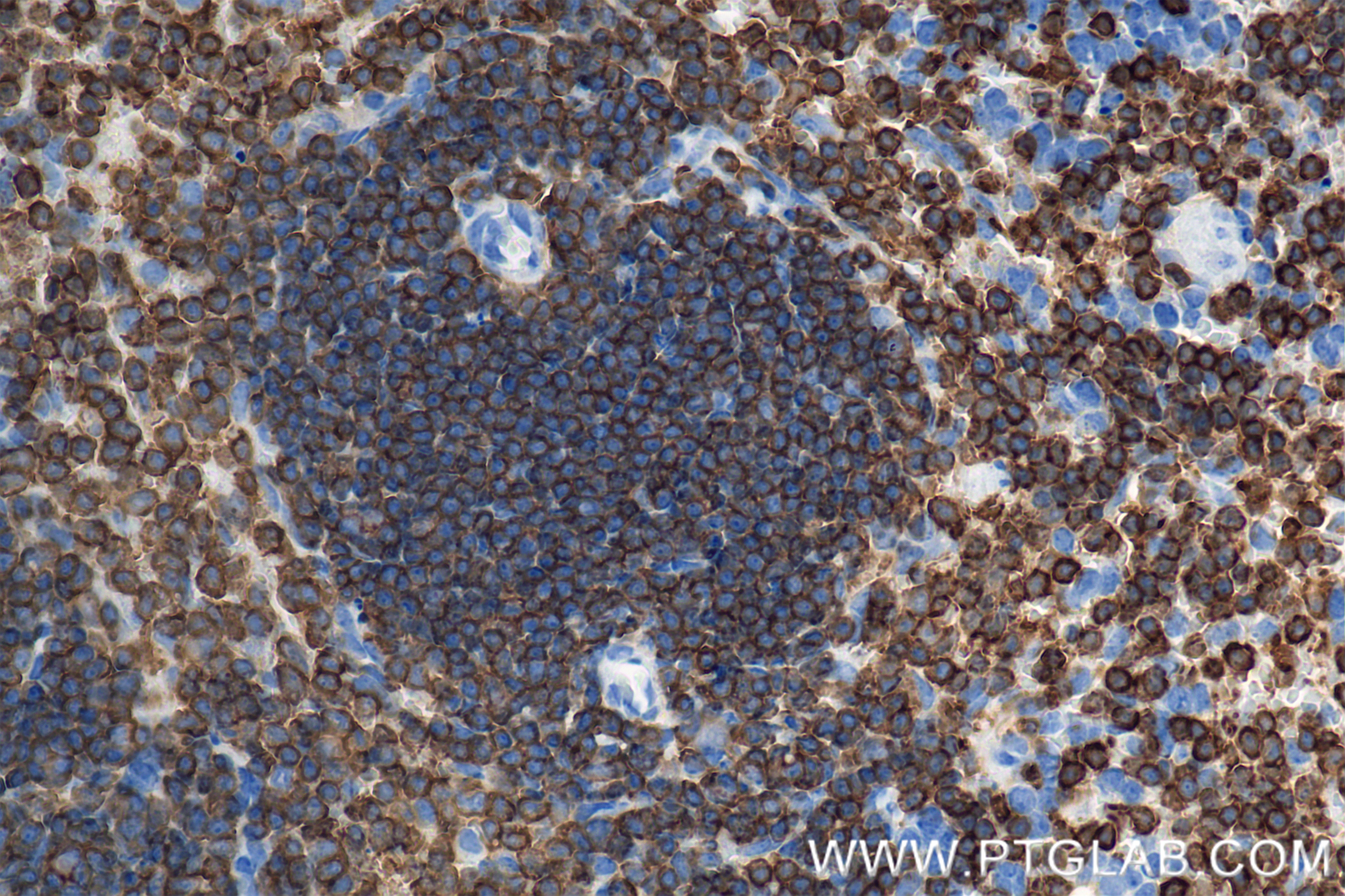 Immunohistochemistry (IHC) staining of mouse spleen tissue using CORO1A Recombinant antibody (84602-5-RR)