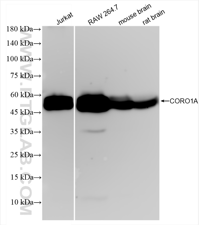 Western Blot (WB) analysis of various lysates using CORO1A Recombinant antibody (84602-5-RR)