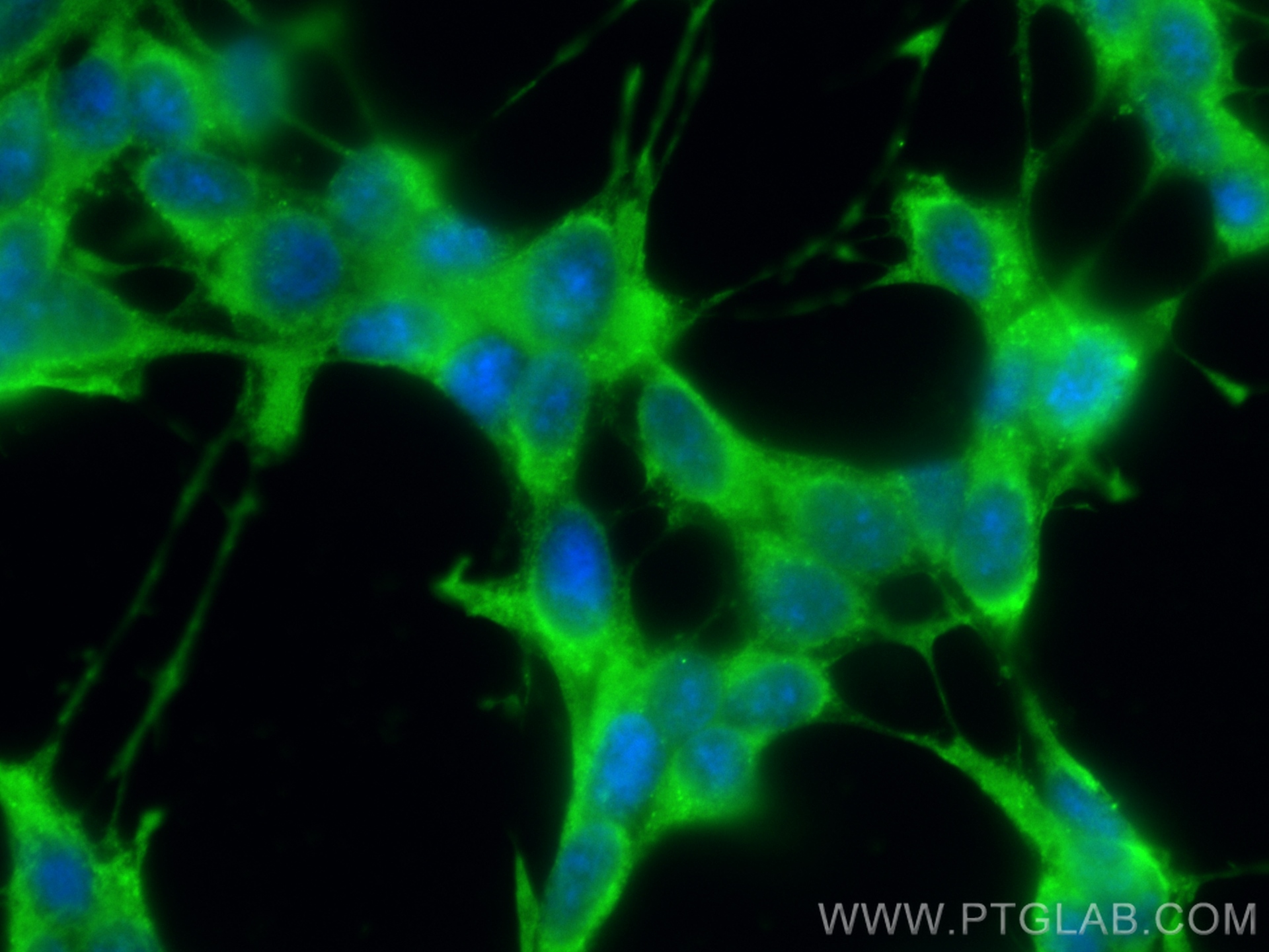 Immunofluorescence (IF) / fluorescent staining of SH-SY5Y cells using CORO1C Monoclonal antibody (68846-1-Ig)