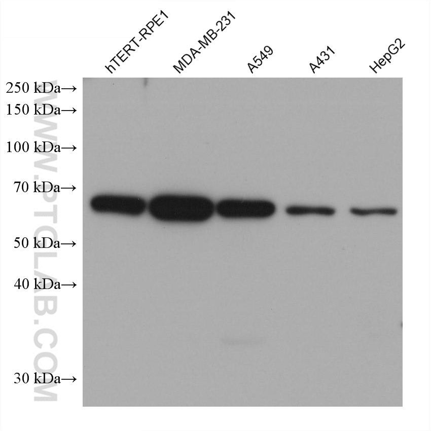 Western Blot (WB) analysis of various lysates using CORO1C Monoclonal antibody (68846-1-Ig)