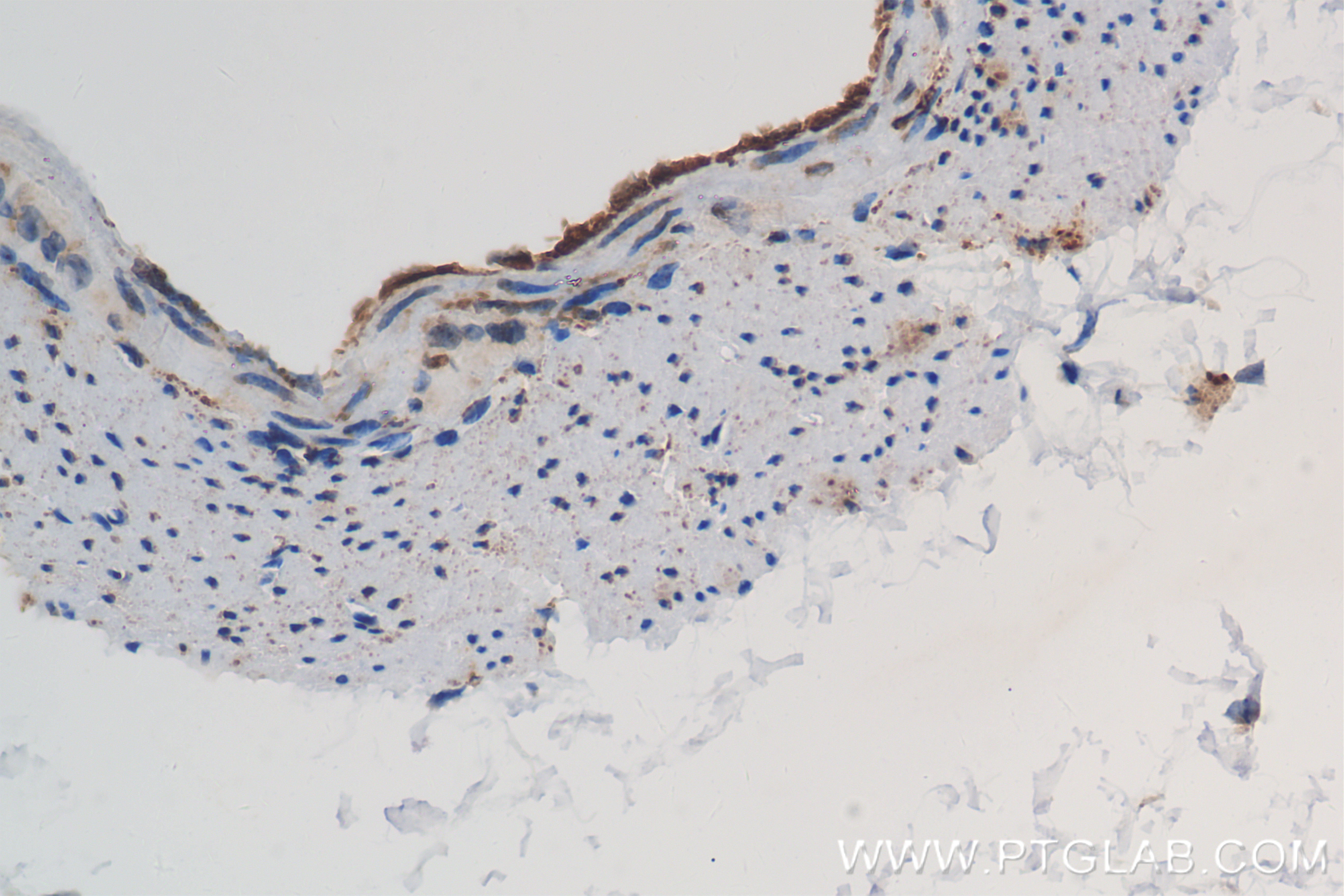 Immunohistochemistry (IHC) staining of mouse stomach tissue using COX-1/Cyclooxygenase-1 Recombinant antibody (84151-4-RR)