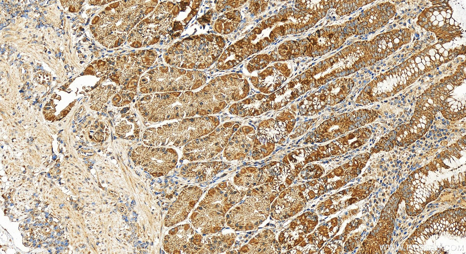 Immunohistochemistry (IHC) staining of human stomach tissue using COX16 Polyclonal antibody (19425-1-AP)