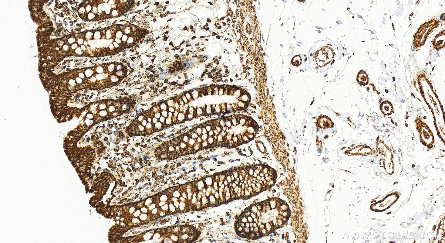 Immunohistochemistry (IHC) staining of human colon tissue using COX5A Polyclonal antibody (11448-1-AP)
