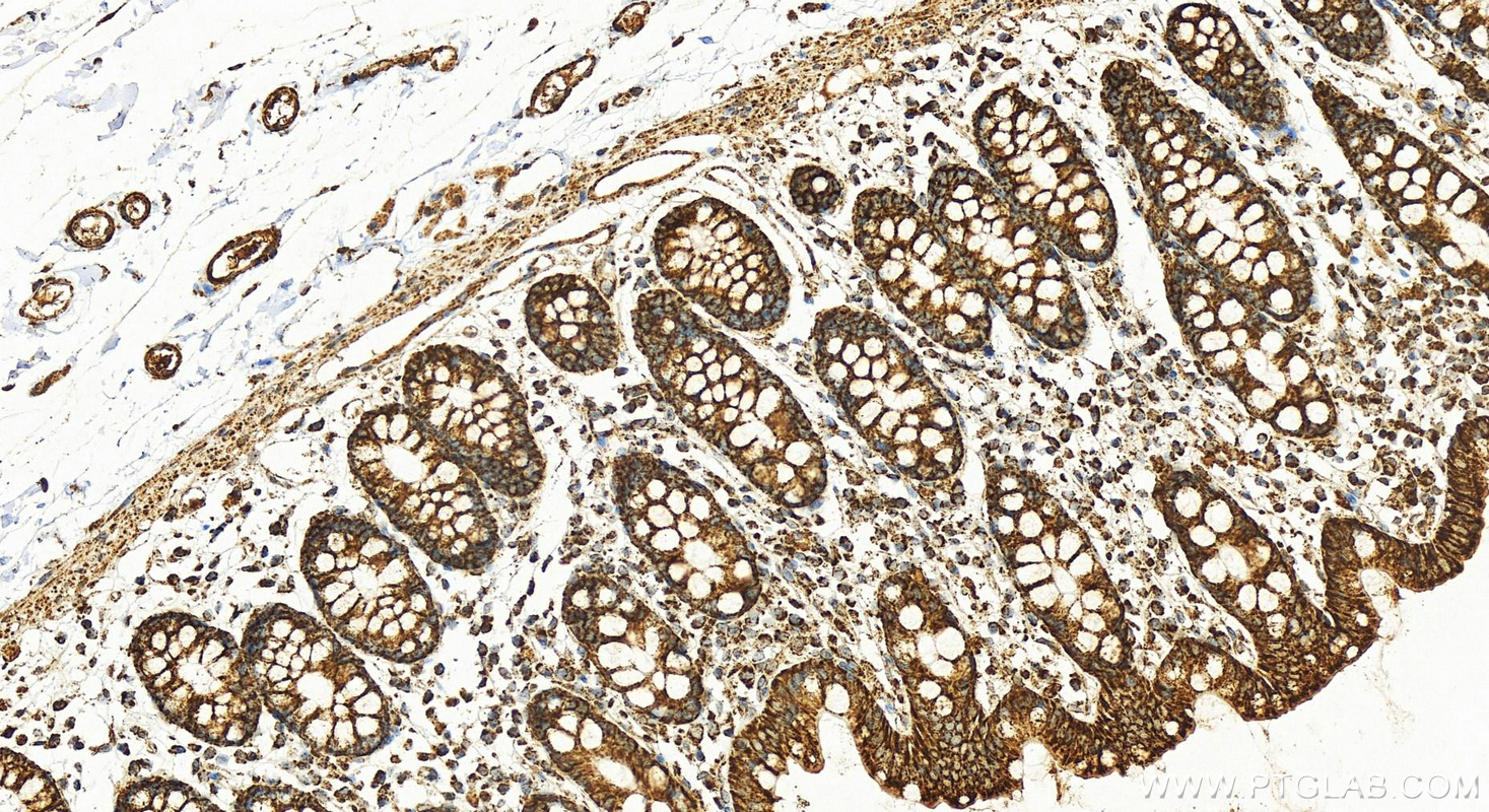 Immunohistochemistry (IHC) staining of human colon tissue using COX5A Polyclonal antibody (11448-1-AP)