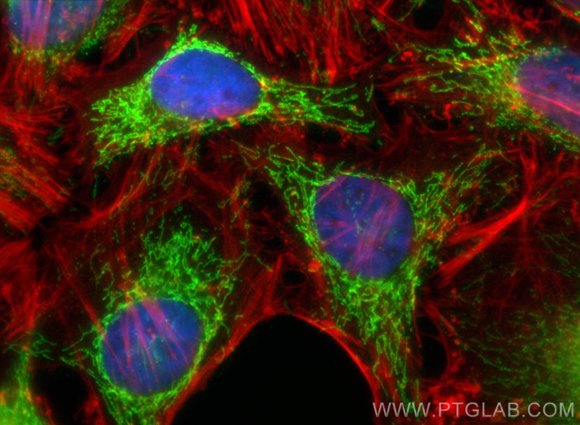 Immunofluorescence (IF) / fluorescent staining of HeLa cells using COX5B Polyclonal antibody (11418-2-AP)