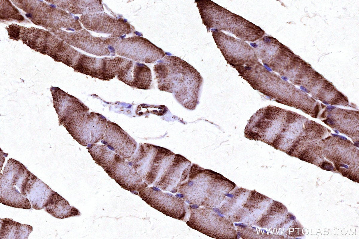 Immunohistochemistry (IHC) staining of mouse skeletal muscle tissue using COX5B Polyclonal antibody (11418-2-AP)
