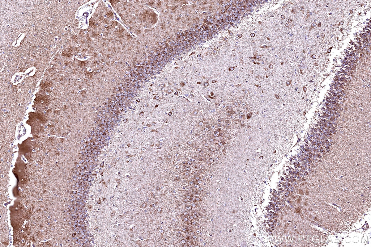 Immunohistochemistry (IHC) staining of rat brain tissue using COX5B Polyclonal antibody (11418-2-AP)
