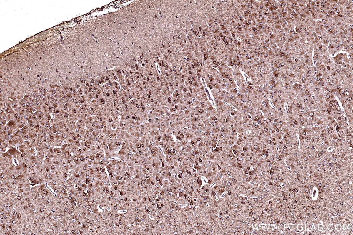 Immunohistochemistry (IHC) staining of rat brain tissue using COX5B Polyclonal antibody (11418-2-AP)