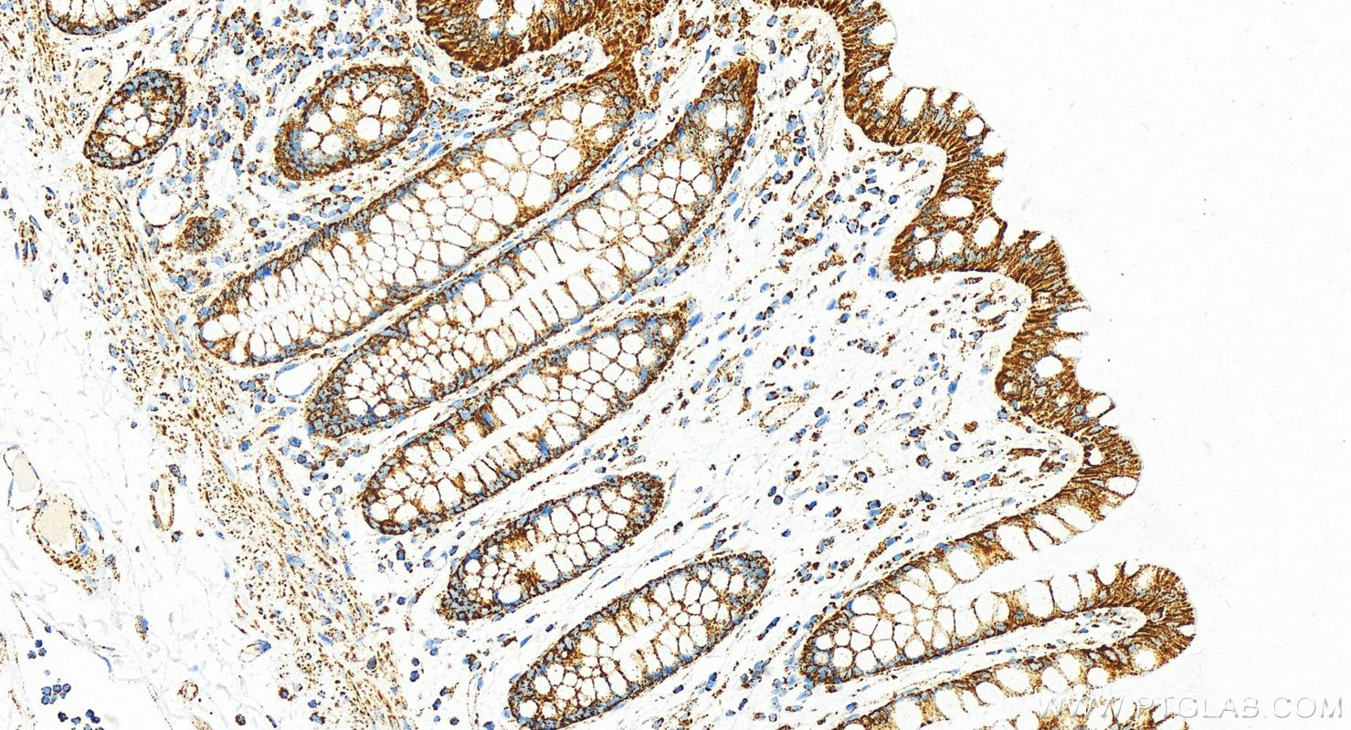 Immunohistochemistry (IHC) staining of human colon tissue using COXIV Recombinant antibody (82916-1-RR)