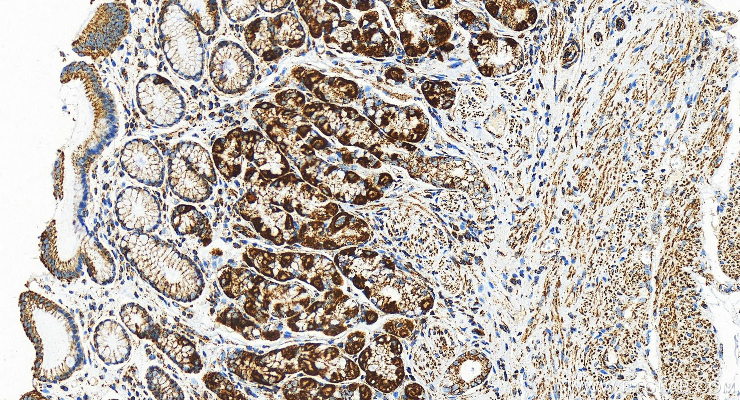 Immunohistochemistry (IHC) staining of human stomach tissue using COXIV Recombinant antibody (82916-1-RR)