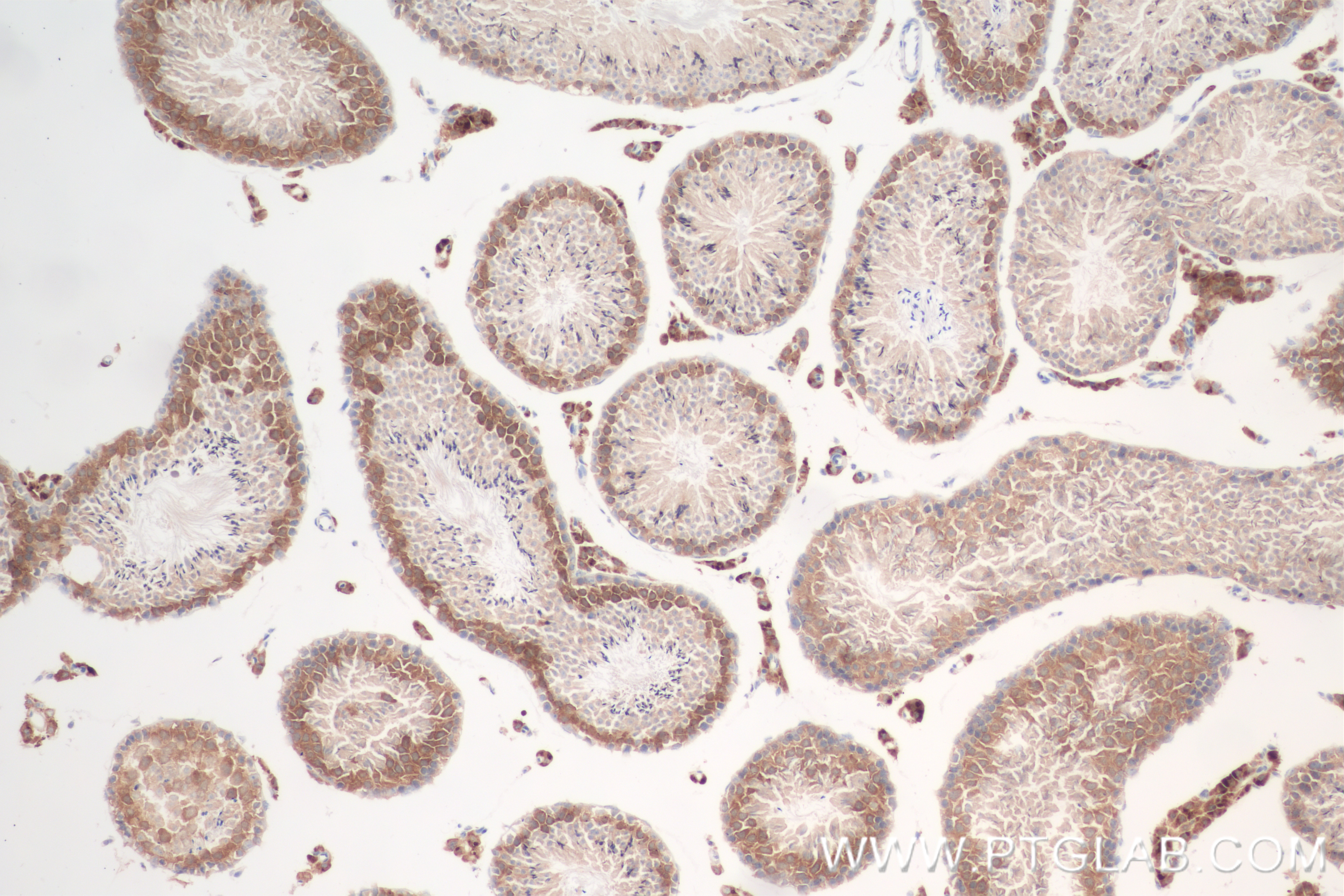 Immunohistochemistry (IHC) staining of mouse testis tissue using CP110 Recombinant antibody (80965-5-RR)