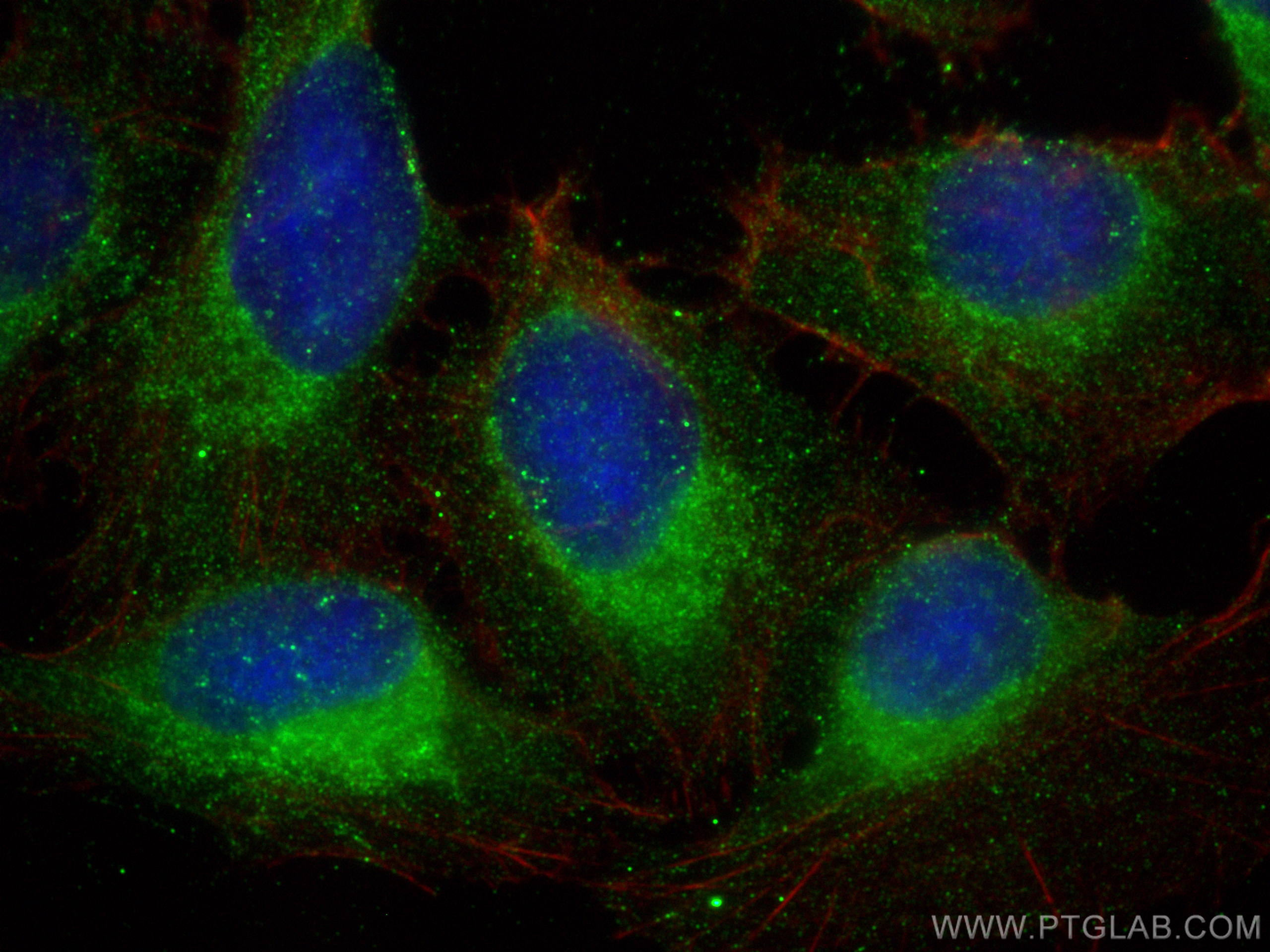 Immunofluorescence (IF) / fluorescent staining of U2OS cells using Carboxypeptidase A1 Polyclonal antibody (15836-1-AP)