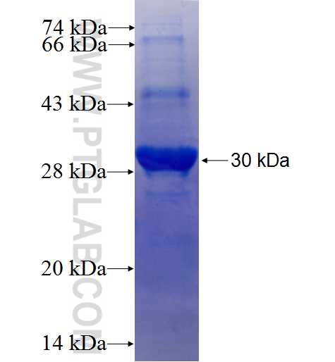 CPA4 fusion protein Ag25318 SDS-PAGE