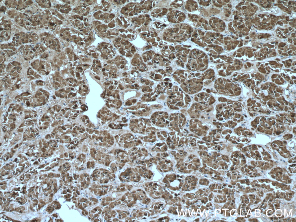 Immunohistochemistry (IHC) staining of human pituitary tissue using Carboxypeptidase E Polyclonal antibody (13710-1-AP)